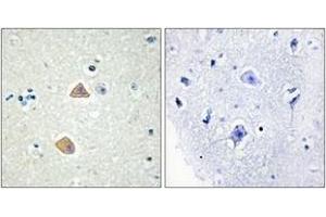 Immunohistochemistry analysis of paraffin-embedded human brain tissue, using EFNA5 Antibody. (Ephrin A5 抗体  (AA 31-80))