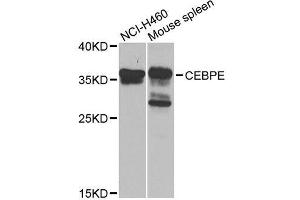 Western blot analysis of extracts of various cell lines, using CEBPE antibody. (CEBPE 抗体  (AA 1-190))