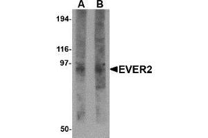 Western blot analysis of EVER2 in rat thymus tissue lysate with AP30324PU-N EVER2 antibody at (A) 1 and (B) 2 μg/ml. (TMC8 抗体  (N-Term))