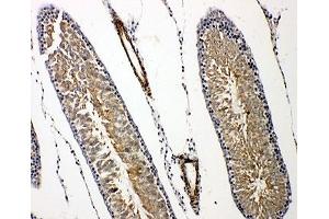 IHC-P: Prolactin Receptor antibody testing of rat testis tissue.