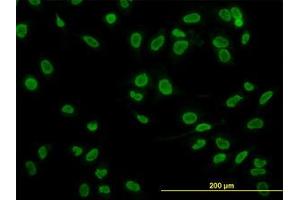Image no. 2 for anti-TATA Box Binding Protein Associated Factor 11 (TAF11) (AA 158-211) antibody (ABIN598957) (TAF11 抗体  (AA 158-211))