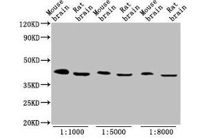 Western Blot Positive WB detected in: Mouse brain tissue, Rat brain tissue All lanes: OCT4 antibody at 1:1000, 1:5000, 1:8000 Secondary Goat polyclonal to Mouse IgG at 1/10000 dilution Predicted band size: 39, 31 kDa Observed band size: 45 kDa (OCT4 抗体  (AA 1-360))