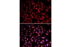 Immunofluorescence analysis of U2OS cells using PRKACB antibody (ABIN5973065). (PRKACB 抗体)