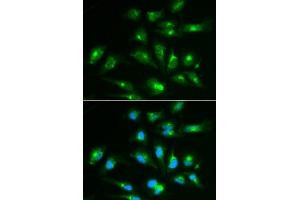 Immunofluorescence analysis of HepG2 cells using CD46 antibody (ABIN6293305). (CD46 抗体)