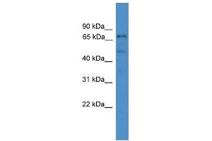 WB Suggested Anti-DDX51 Antibody Titration:  0. (DDX51 抗体  (Middle Region))