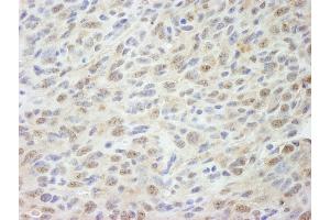 Immunohistochemistry (IHC) image for anti-Mediator Complex Subunit 18 (MED18) (C-Term) antibody (ABIN7448663) (MED18 抗体  (C-Term))