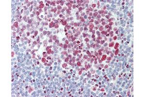 Anti-HNRNPAB antibody IHC staining of human tonsil. (HNRNPAB 抗体  (AA 1-30))