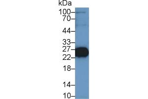 Western Blot; Sample: Mouse Skeletal muscle lysate; Primary Ab: 1µg/ml Rabbit Anti-Rat TNNI2 Antibody Second Ab: 0. (TNNI2 抗体  (AA 1-182))