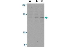 Western blot analysis of BCL2 in A-20 cell lysates with BCL2 polyclonal antibody  at (A) 1, (B) 2, and (C) 4 ug/mL . (Bcl-2 抗体  (Internal Region))