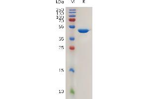 Human I Protein, hFc Tag on SDS-PAGE under reducing condition.
