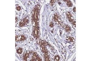 Immunohistochemical staining of human breast with C1orf35 polyclonal antibody  shows moderate cytoplasmic and nuclear positivity in glandular cell at 1:500-1:1000 dilution. (C1orf35 抗体)
