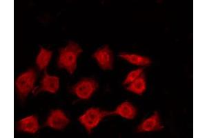 ABIN6272324 staining K562 by IF/ICC. (CBX3 抗体  (Internal Region))