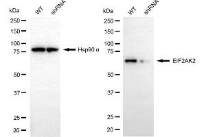 Western blotting analysis using EIF2AK2 antibody (ABIN7798506). (EIF2AK2 抗体)