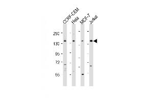 All lanes : Anti-PLCG1 Antibody (Center) at 1:2000 dilution Lane 1: CCRF-CEM whole cell lysates Lane 2: Hela whole cell lysates Lane 3: MCF-7 whole cell lysates Lane 4: Jurkat whole cell lysates Lysates/proteins at 20 μg per lane. (Phospholipase C gamma 1 抗体  (AA 456-488))