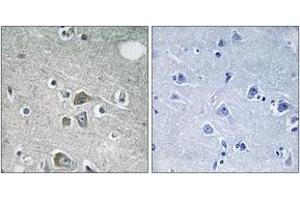 Immunohistochemistry (IHC) image for anti-Fibulin 2 (FBLN2) (AA 241-290) antibody (ABIN2890318) (FBLN2 抗体  (AA 241-290))