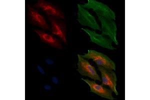 ABIN6257350 and ABIN6274727 staining  cells by IF/ICC. (MRPL11 抗体  (Internal Region))