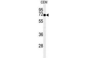 Western blot analysis of MFSD6 Antibody (C-term) in CEM cell line lysates (35µg/lane).