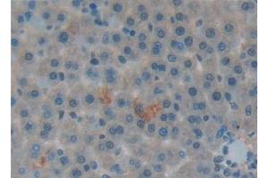 Immunohistochemistry (IHC) image for anti-Surfactant Protein A1 (SFTPA1) (AA 21-248) antibody (ABIN7432871)