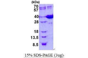 Image no. 1 for Galectin 4 (LGALS4) (AA 1-326) (Active) protein (His tag) (ABIN1098441)
