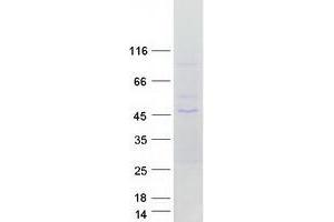 Western Blotting (WB) image for Guanine Nucleotide Binding Protein (G Protein), alpha 11 (Gq Class) (GNA11) protein (Myc-DYKDDDDK Tag) (ABIN2721492)