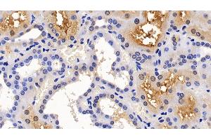 Immunohistochemistry (IHC) image for anti-Angiotensin I Converting Enzyme 2 (ACE2) (AA 392-739) antibody (ABIN7434278)