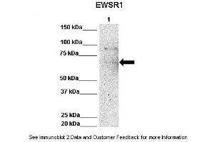 Lanes:   Lane 1: 50ug Hela Lysate  Primary Antibody Dilution:   1:1000  Secondary Antibody:   Anti-rabbit-HRP  Secondary Antibody Dilution:   1:10,000  Gene Name:   EWSR1  Submitted by:   Archa Fox, University of Western Australia  EWSR1 is strongly supported by BioGPS gene expression data to be expressed in Human HeLa cells (EWSR1 抗体  (Middle Region))