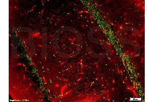 Formalin-fixed and paraffin embedded rat brain tissue labeled with Anti-BrdU(A7) Monoclonal Antibody, FITC Conjugated (ABIN706721) at 1:200 for 40 minutes at 37°C followed by labeling Rabbit Anti-Tubulin Beta, Cy3 conjugated 1:200, 40 minutes at 37°C (TUBB 抗体  (AA 61-160))