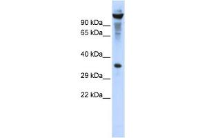WB Suggested Anti-RNASET2 Antibody Titration:  0. (RNASET2 抗体  (Middle Region))