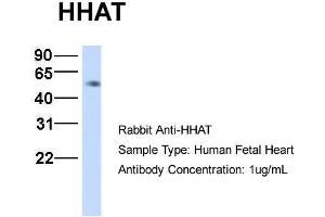 Host:  Rabbit  Target Name:  HHAT  Sample Type:  Human Fetal Heart  Antibody Dilution:  1. (HHAT 抗体  (N-Term))