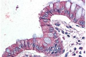 Human Colon (formalin-fixed, paraffin-embedded) stained with GPR116 antibody ABIN399995 at 10 ug/ml followed by biotinylated goat anti-rabbit IgG secondary antibody ABIN481713, alkaline phosphatase-streptavidin and chromogen. (G Protein-Coupled Receptor 116 抗体  (Internal Region))