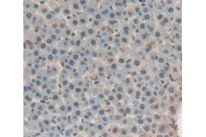 IHC-P analysis of liver tissue, with DAB staining. (THYN1 抗体  (AA 1-226))