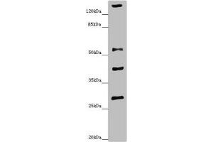 Western blot All lanes: ZSCAN26antibody at 1. (ZNF187 抗体  (AA 239-478))