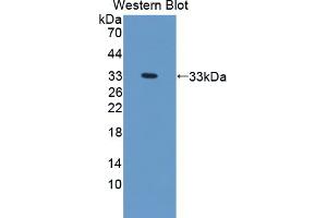 Western blot analysis of the recombinant protein. (TREH 抗体  (AA 151-411))