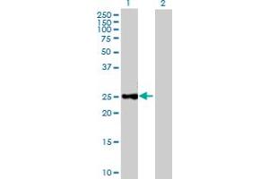 Western Blot analysis of CTRB1 expression in transfected 293T cell line by CTRB1 MaxPab polyclonal antibody. (CTRB1 抗体  (AA 1-263))