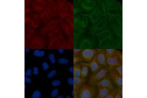 SPPL2B Mouse Monoclonal Antibody staining Hela cells by IF/ICC.
