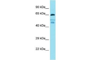 Western Blotting (WB) image for anti-Fidgetin-Like 2 (FIGNL2) (Middle Region) antibody (ABIN2791546) (Fidgetin-Like 2 抗体  (Middle Region))