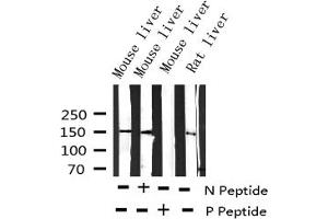Western blot analysis of Phospho-EGFR (Tyr1197) expression in various lysates (EGFR 抗体  (pTyr1197))