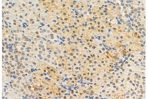 ABIN6262226 and ABIN6272920 at 1/100 staining Rat kidney tissue by IHC-P.