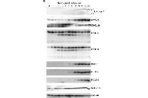Western blot validation of host protein regulation. (ISG15 抗体)