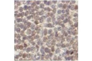 Immunohistochemistry (IHC) image for anti-Cyclin D1 (CCND1) antibody (ABIN1106871) (Cyclin D1 抗体)