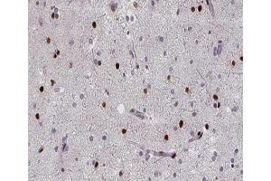 ABIN6267394 at 1/200 staining human brain tissue sections by IHC-P. (RPA2 抗体  (pThr21))