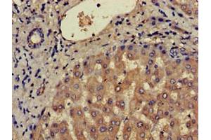 Immunohistochemistry of paraffin-embedded human liver tissue using ABIN7145926 at dilution of 1:100 (CCR3 抗体  (AA 306-355))