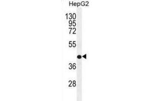 Western Blotting (WB) image for anti-Retinol Dehydrogenase 13 (All-Trans and 9-Cis) (RDH13) antibody (ABIN2996498) (RDH13 抗体)
