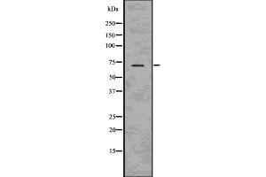 Western blot analysis of BACE using HeLa whole cell lysates (BACE1 抗体  (C-Term))