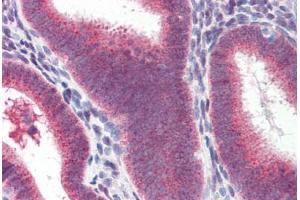 Human Uterus (formalin-fixed, paraffin-embedded) stained with Heat Shock Protein 70 (HSP70) antibody ABIN364327 at 10 ug/ml followed by biotinylated anti-mouse IgG secondary antibody ABIN481714, alkaline phosphatase-streptavidin and chromogen. (HSP70 抗体  (AA 1-641))