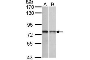 Western Blotting (WB) image for anti-Zinc Finger Protein 398 (ZNF398) (AA 358-630) antibody (ABIN467495) (ZNF398 抗体  (AA 358-630))