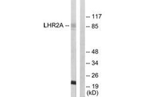 Western blot analysis of extracts from 293 cells, using LHR2A Antibody. (VWA5A 抗体  (AA 371-420))