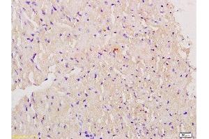 Formalin-fixed and paraffin embedded mouse myocardium labeled with Anti-Myoglobin Polyclonal Antibody, Unconjugated  at 1:200 followed by conjugation to the secondary antibody and DAB staining. (Myoglobin 抗体  (AA 21-120))