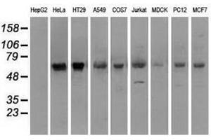 Image no. 2 for anti-Premelanosome Protein (PMEL) antibody (ABIN1500301) (Melanoma gp100 抗体)