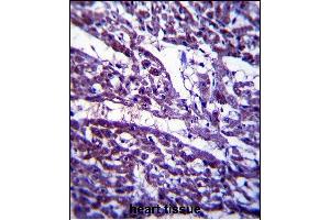 Immunohistochemistry (Paraffin-embedded Sections) (IHC (p)) image for anti-Tubulin, gamma Complex Associated Protein 5 (TUBGCP5) (AA 172-201), (N-Term) antibody (ABIN657500)